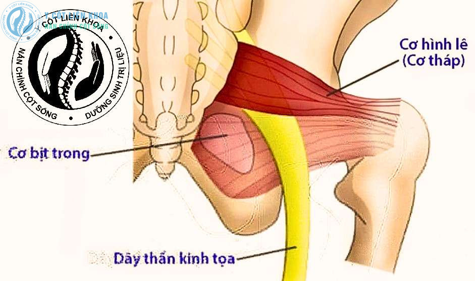 cơ hình lê và dây thần kinh tọa bị chèn ép gây đau lan từ mông xuống chân