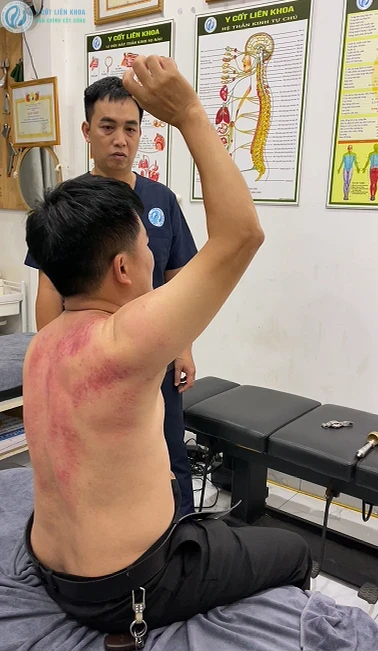 Nguyễn Chính kiểm tra lại khả năng nâng tay của người bệnh sau trị liệu